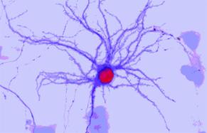 Hippocampal neuron after 15 days of culture