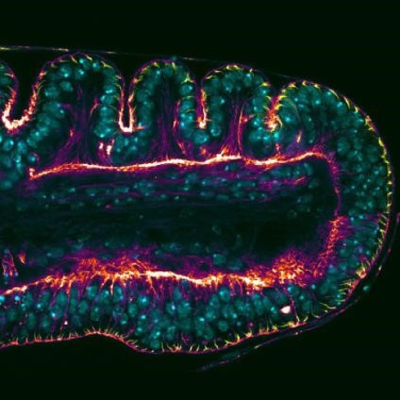 La mosca del vinagre arroja nuevas luces sobre el control genético de la formación de órganos