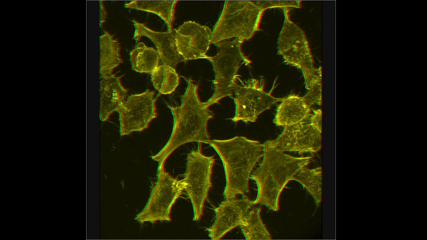 Imagen estereoscópica de células HeLa. Dr. Francisco Sanz