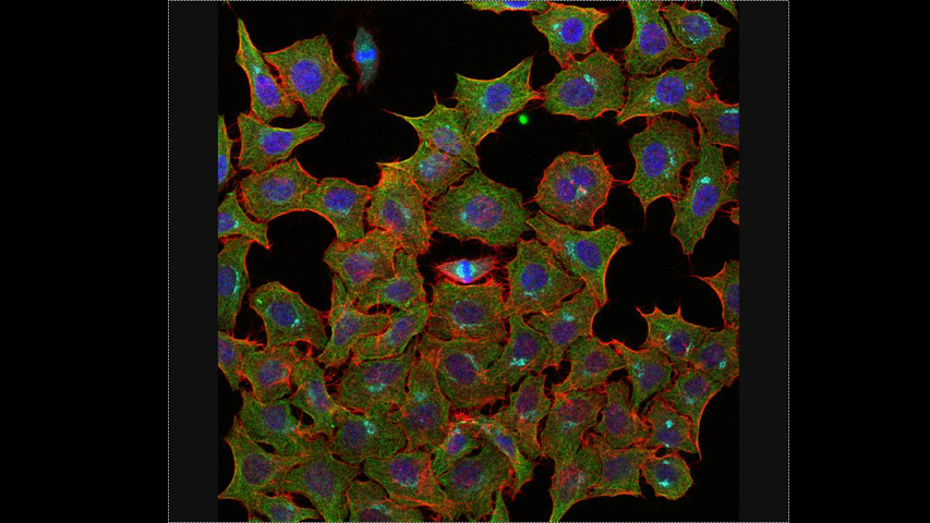 Marcaje triple de células HeLa. Dr. Francisco Sanz