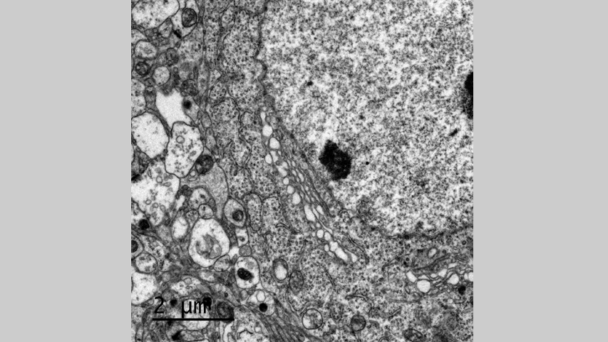 Microscopía Electrónica de Transmisión