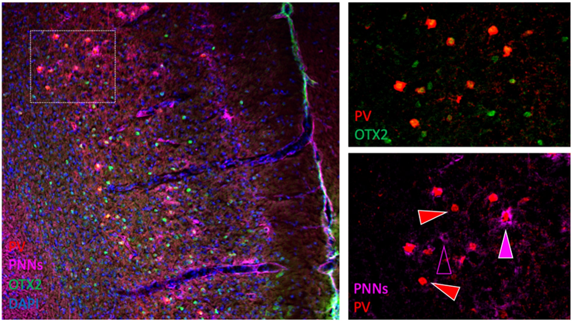Fotografías de detalle de la corteza prefrontal donde se observa como la OTX2 se internaliza en las neuronas PV