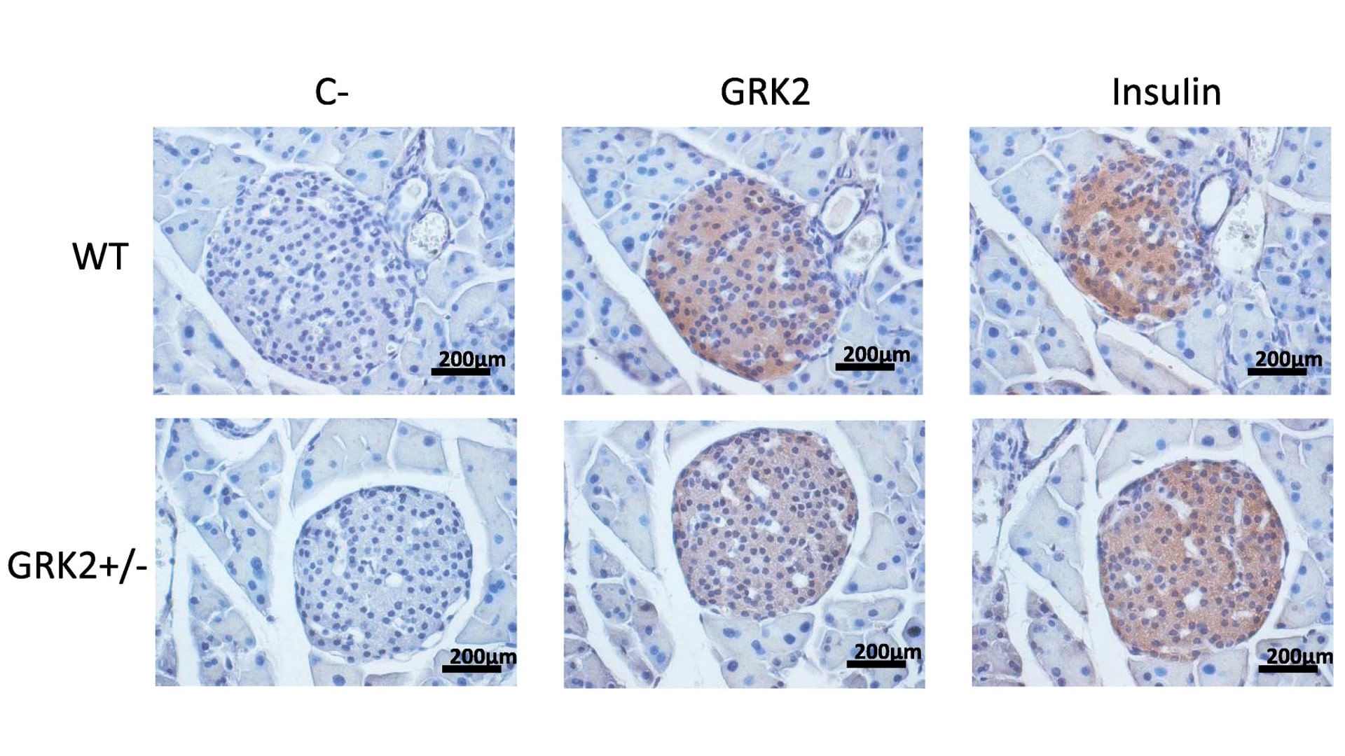 Imágenes que muestran la localización específica de la proteína GRK2 en el islote pancreático y niveles de expresión de GRK2 en el páncreas de ratones WT y GRK2 +/−