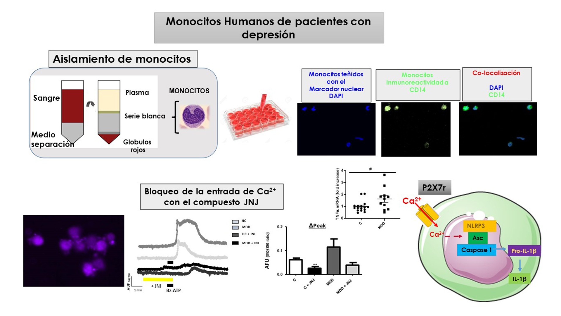 Imagen que muestra el protocolo de extracción de monocitos en pacientes.