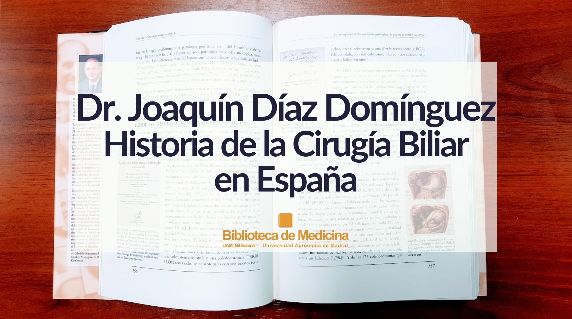 Dr. Joaquín Díaz Domínguez: Historia de la Cirugía Biliar en España