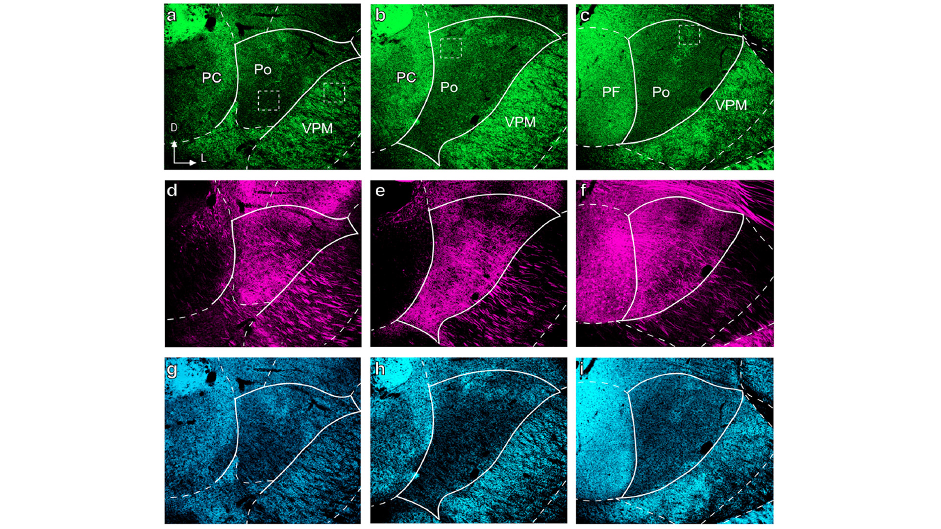 Imagen que compara en microscopia de fluorescencia confocal la distribución en el núcleo posterior (Po) del tálamo de las terminaciones sinápticas procedentes del tronco del encéfalo y de la médula espinal (en verde) o de la corteza cerebral (en rojo).