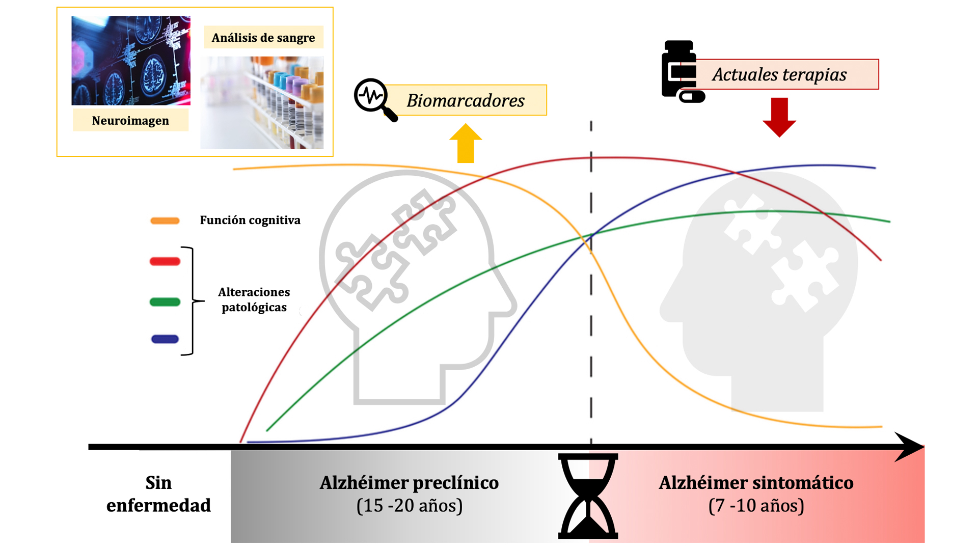 Diagrama que muestra el tiempo del alzhéimer