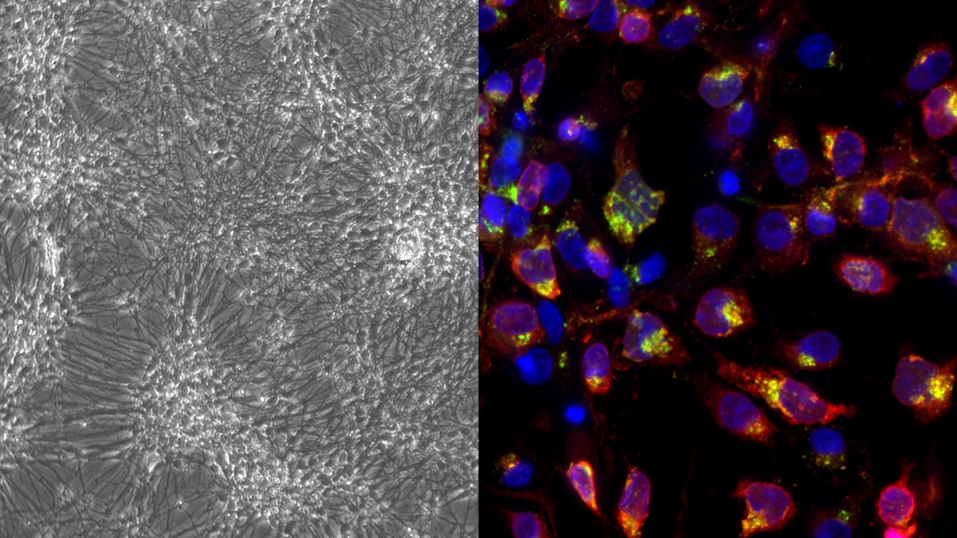Dos fotografías de células afectadas tomadas por un microscopio, donde en colores se distinguen diferentes formas redondeadas.