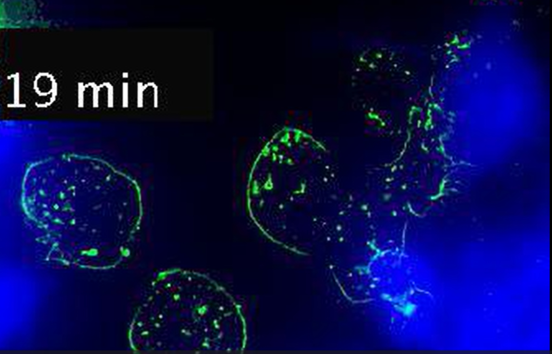Imágenes de linfocitos interactuando marcados en azul y verde sobre fondo blanco.