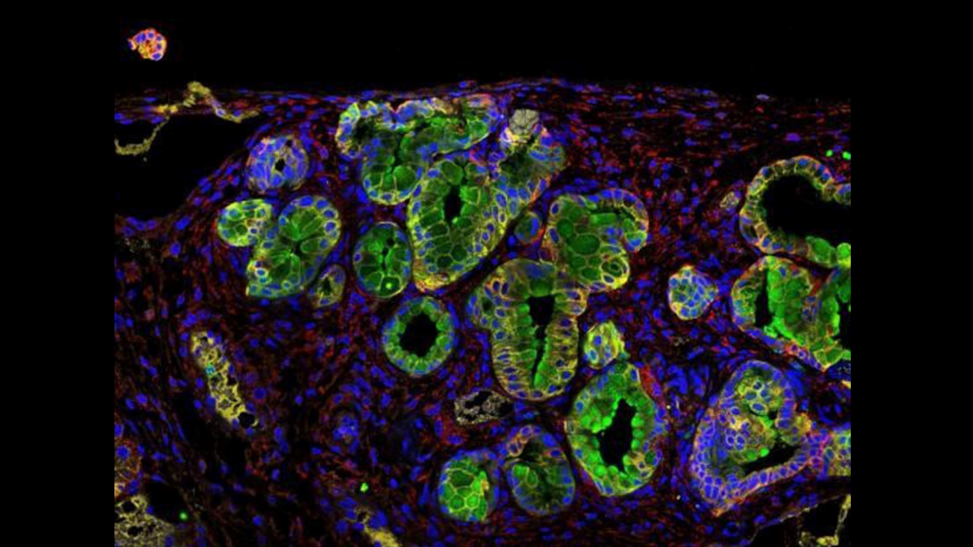 Imagen de fondo negro y formas redondeadas de fluorescencia de varios colores.