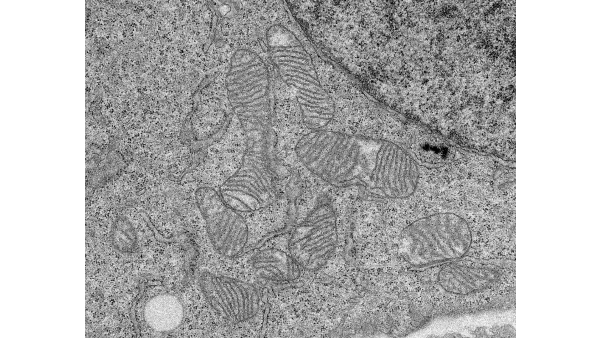 Mitocondrias observadas con el microscopio electrónico. / Eduardo Balsa