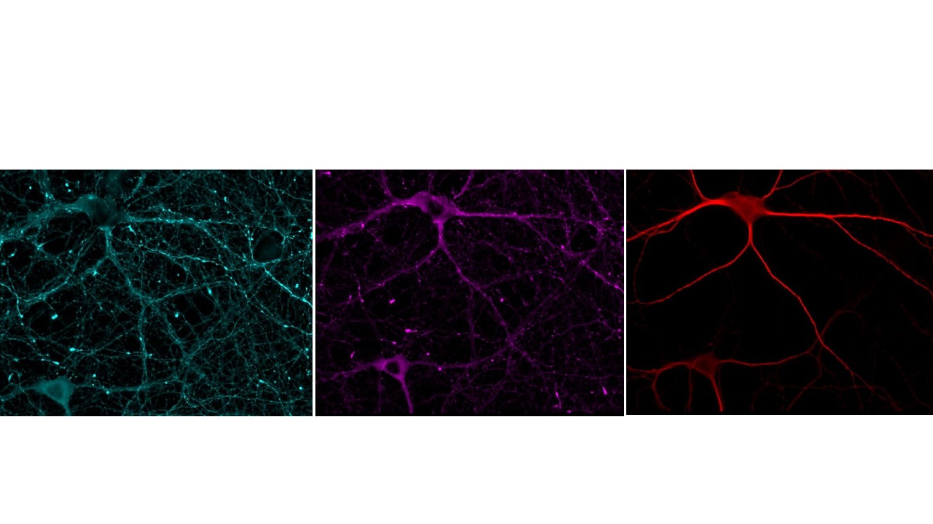 Imagen de microscopía que muestra neuronas teñidas con marcadores estudiados en este trabajo / F. Javier Díez Guerra, CBM