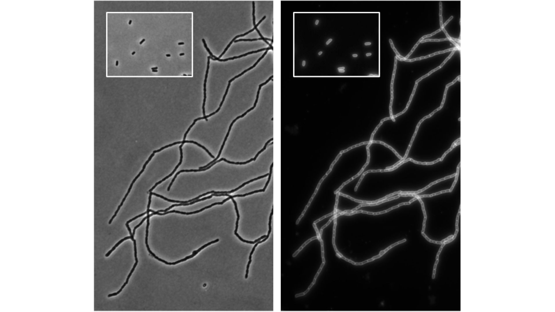 Cuando la proteína SddA está en exceso, las bacterias no logran separarse bien y forman cadenas de células. Imagen principal, cadenas de células de E. coli formadas tras la producción en exceso de SddA; recuadro, apariencia normal de células individuales de E. coli. Izquierda, imágenes de microscopía de contraste de fases; derecha, mismas bacterias con sus membranas marcadas con fluorescencia.
