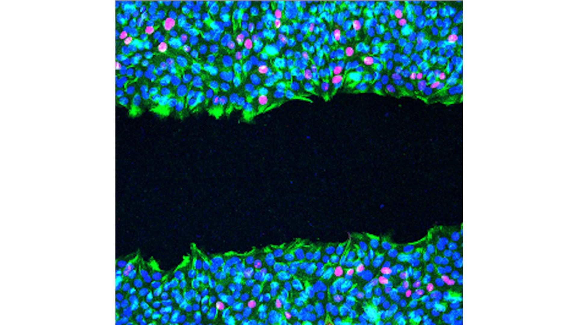 magen de microscopía de fluorescencia de células epiteliales mamarias que expresan la variante patogénica c.5946delT en las que se ha hecho el ensayo de brecha o “wound healing” para evaluar la migración celular:  Vimentina (en verde), ADN (azul), marcador de proliferación en magenta (Ki67). /Jesús Gómez-Escudero, CBM