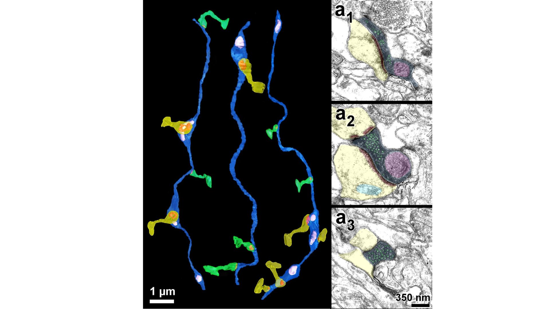 Reconstrucción tridimensional de axones talamocorticales obtenida mediante microscopía electrónica FIB-SEM. Las sinapsis con neuronas corticales se muestran en rojo y las mitocondrias en rosa. Las espinas dendríticas aparecen en amarillo o verde según contacten en regiones varicosas o no varicosas del axón. A la derecha, secciones ultrafinas de contactos sinápticos donde se observan vesículas de neurotransmisor y mitocondrias en el interior del axón / UAM