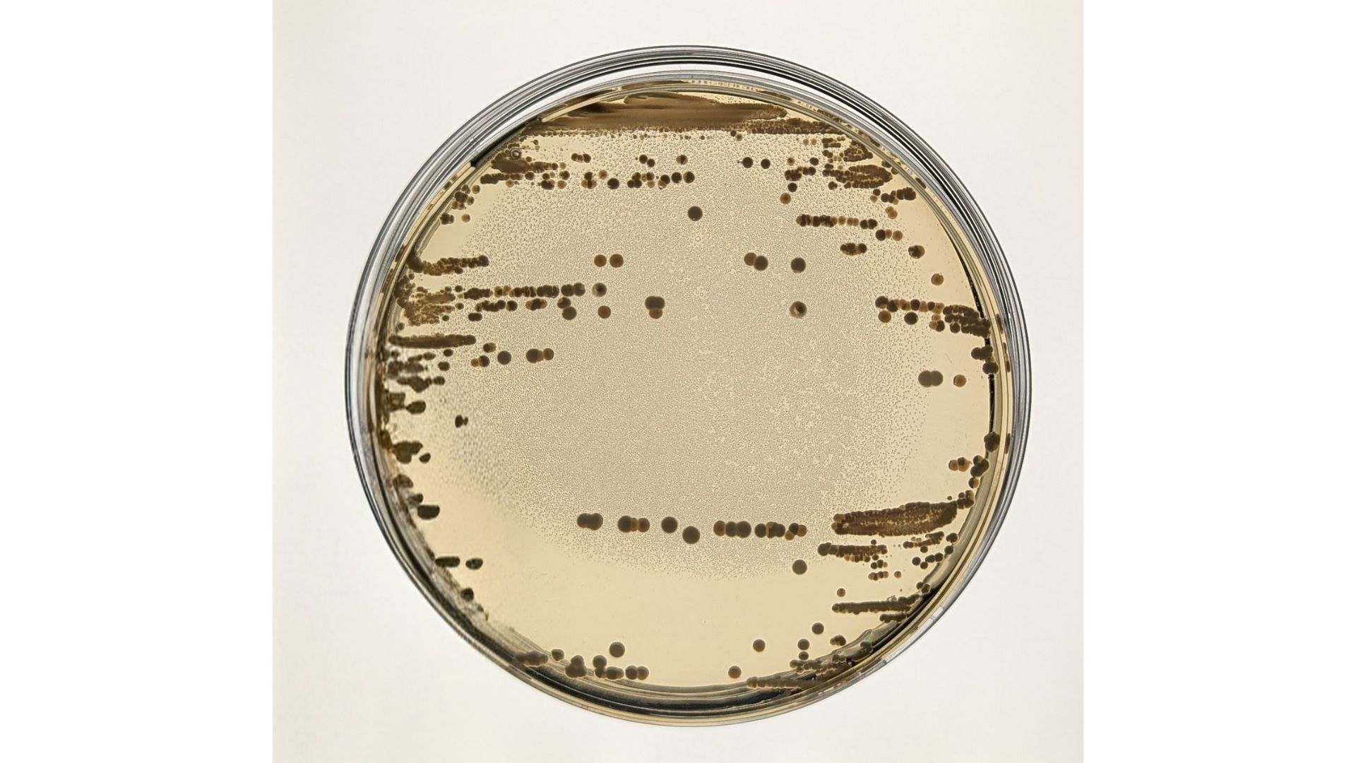 Imagen de placas de cultivo con cepas clínicas de Klebsiella pneumoniae. / CNB-CSIC
