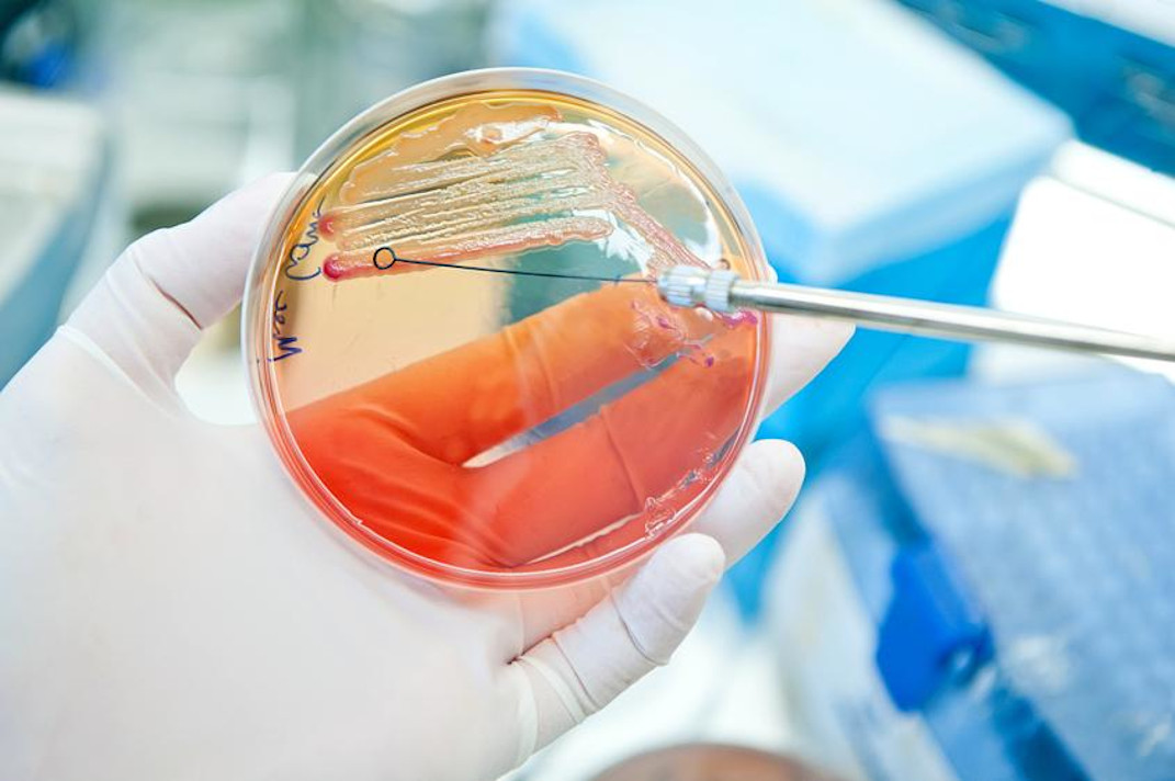 Placa de Petri con cultivo bacteriano siendo manipulado con una herramienta de laboratorio por una persona con guantes