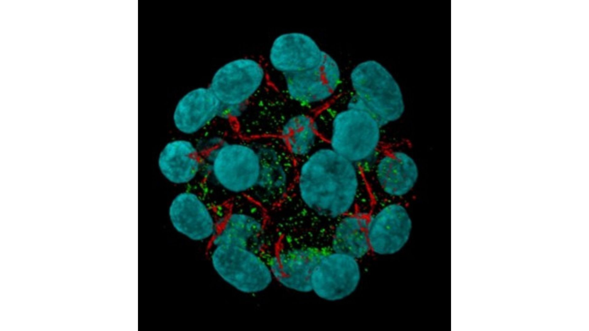 Imagen de microscopía que muestra un organoide humano como los utilizados en el estudio. / Fernando Martín Belmonte CBM (UAM-CSIC)