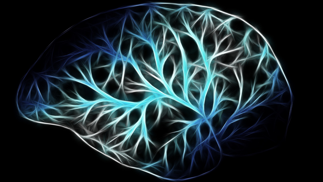 cerebro