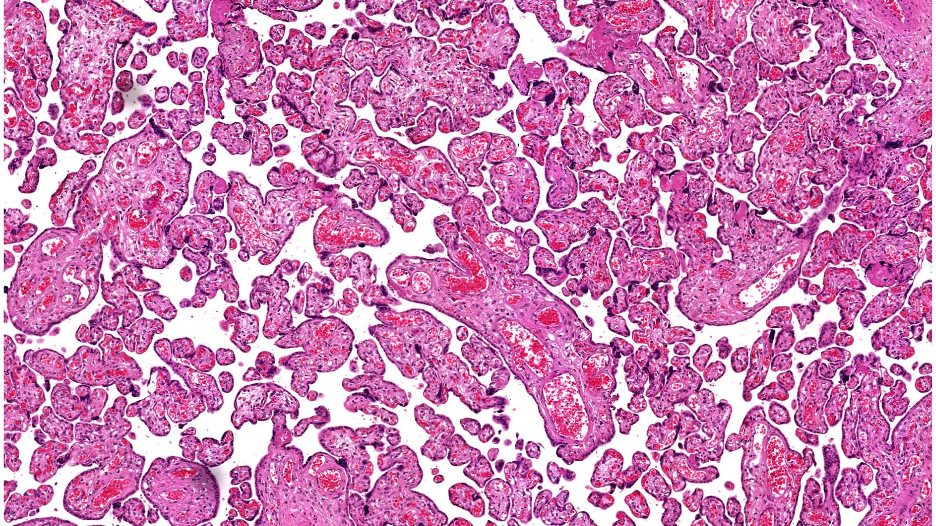 Corte histológico de una placenta humana teñido con hematoxilina y eosina / (IIBM) CSIC-UAM