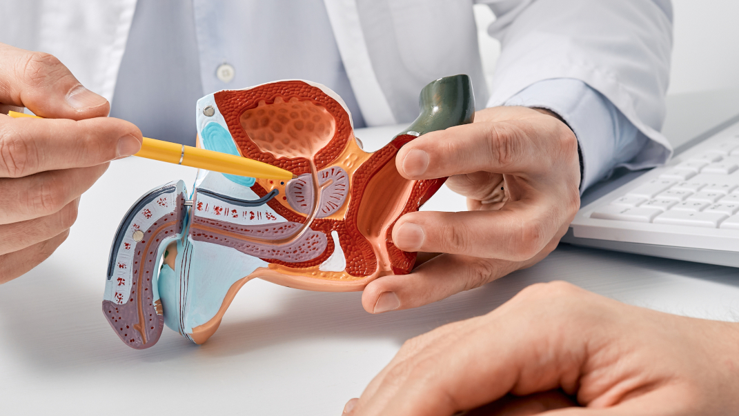 medico enseñando maqueta de próstata