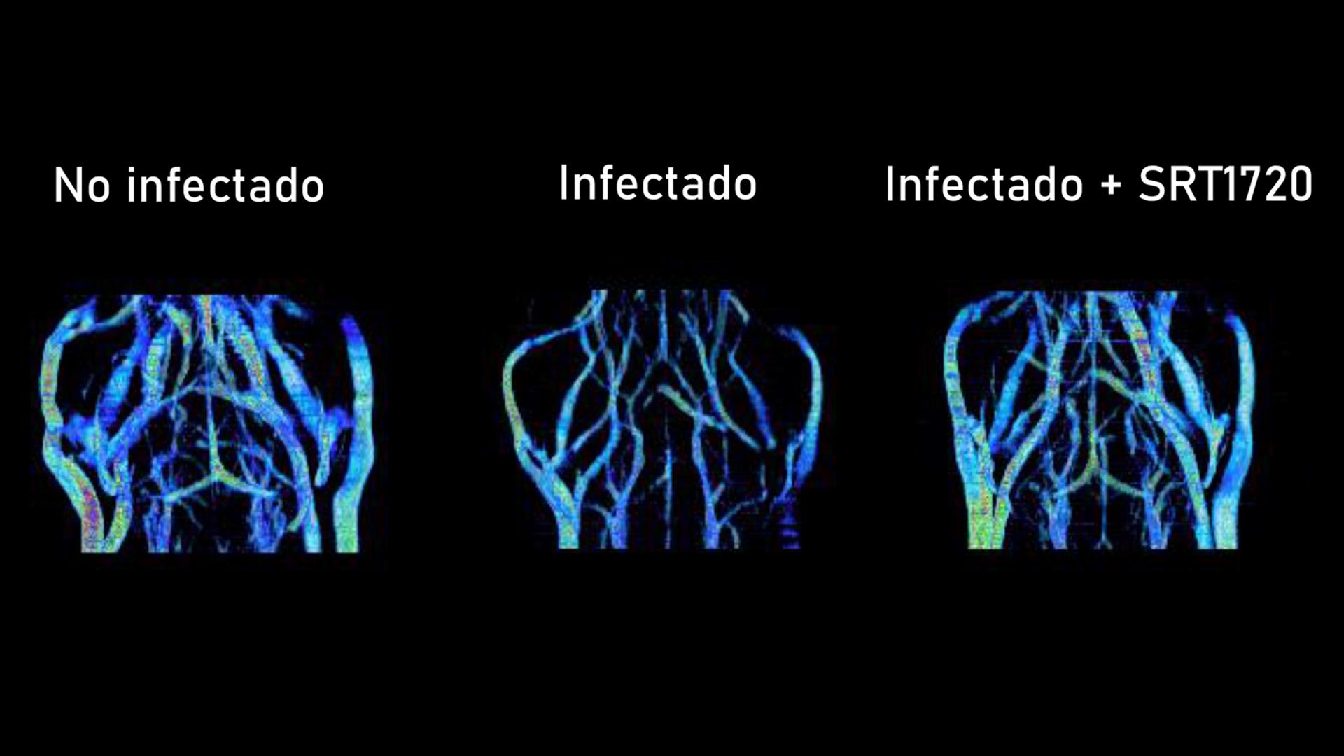 Posible nueva terapia contra la malaria cerebral UAM